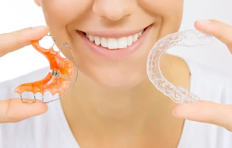 Ile kosztują nakładki Invisalign?
