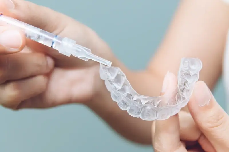 Invisalign plan leczenia