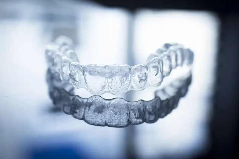 Jak długo trwa leczenie Invisalign?