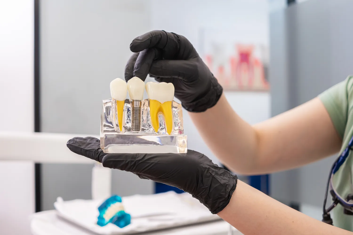 Implanty zębów - czy mogą nam zastąpić prawdziwe zęby?