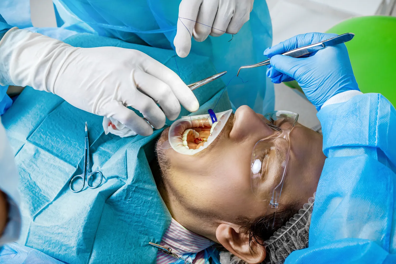 Powiększanie ust Lublin