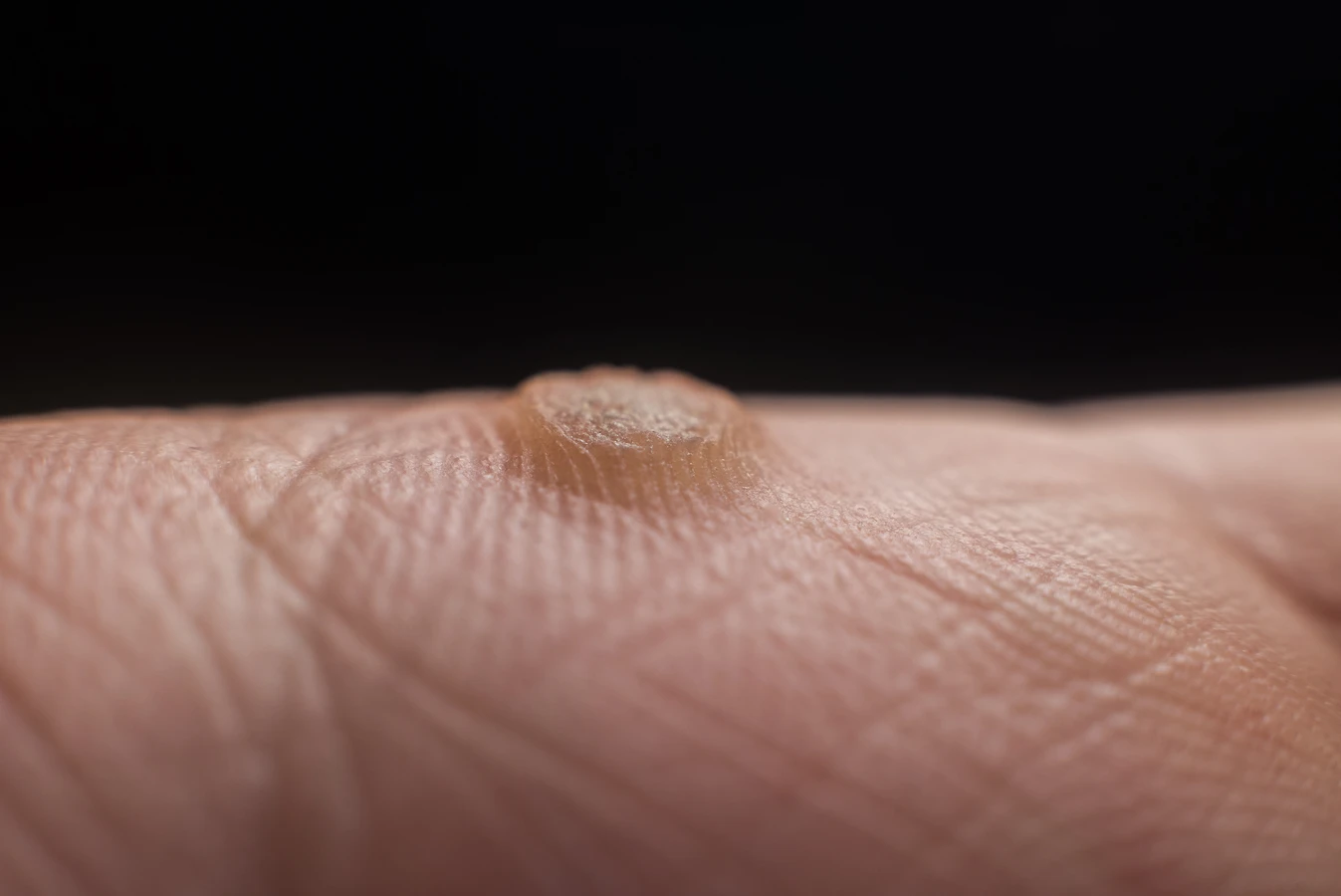 Podologia - sposób na zdrowe i piękne stopy